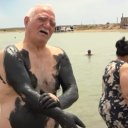 Yüzlərlə insan axışır, amma... - Hövsandakı "möcüzəvi palçıq" barədə həkimdən kritik XƏBƏRDARLIQ