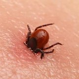 Azərbaycanda son 30 ildə bu xəstəlik aşkarlanmayıb -&nbsp;RƏSMİ