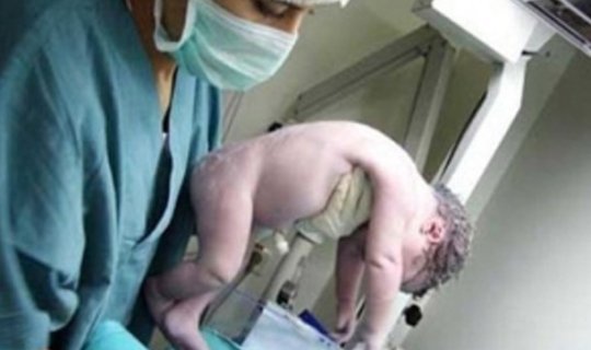Tibb bacısı yeni doğulmuş körpəni öldürdü