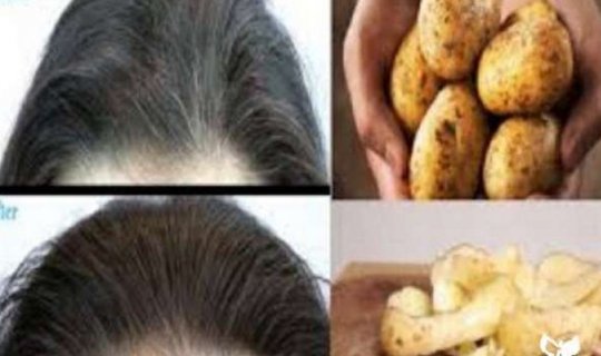 Kartof qabığı ilə ağ saçlara son