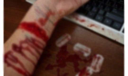Polis İdarəsində 27 yaşlı gənc damarlarını doğradı