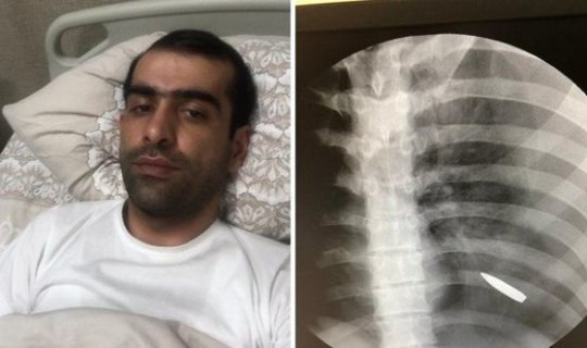 Bərdə indiyə qədər gördüklərimin ən qorxulusu idi: Cəbhədə könüllü xidmət etmiş həkimlə MÜSAHİBƏ