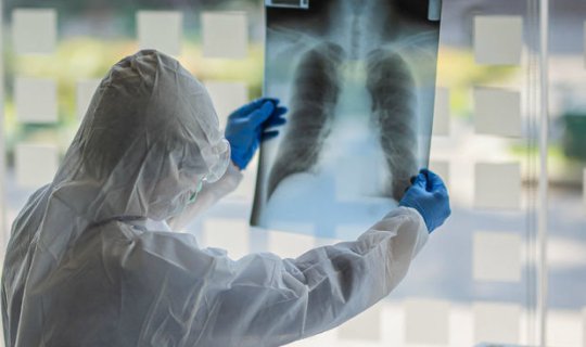Buzlu şüşə diaqnozu qoyulan koronavirus xəstələri nə etməlidirlər? - Həkimdən AÇIQLAMA