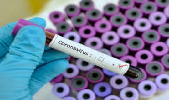 Azərbaycanda ilkin olaraq səhiyyə işçiləri və 65 yaşdan yuxarı şəxslər koronavirusa qarşı vaksinasiya olunacaq