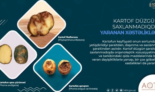 Kartofu düzgün saxlamadıqda hansı xəstəliklərə səbəb olur?