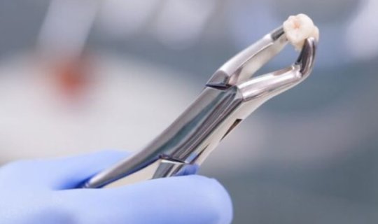 Gələcəkdə protez dişlərə ehtiyyac qalmayacaq:xa0Yapon alimləri mümkünsüzü bacardı