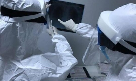 Koronavirus ömrü qısaldır? - Professor açıqladı