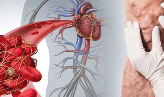 30 dərəcə istidə tromb yaranma riski artır - Kardioloqdan MƏSLƏHƏT