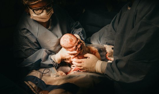 Qeysəriyyə əməliyyatından qısa zaman sonra olan hamiləliyi sonlandırmayın - Həkim