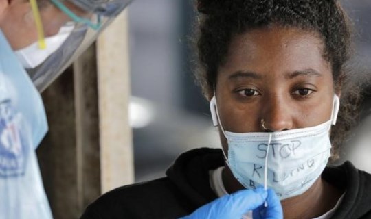 Koronavirus ölüm sayında milyonluq fərq yaradıb