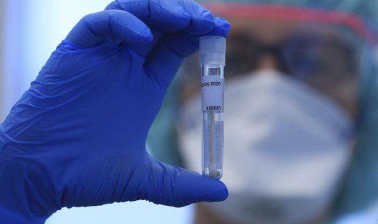 Koronavirusa yoluxanların sayı açıqlandı
