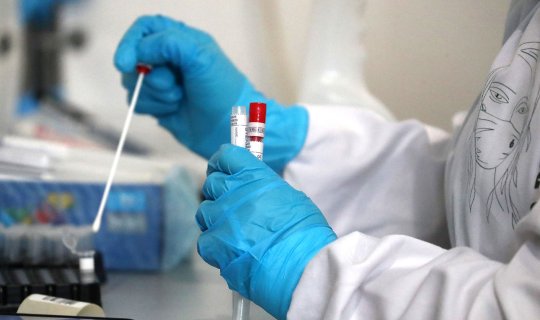 Koronavirusun ən yeni dərmanı Azərbaycanda var