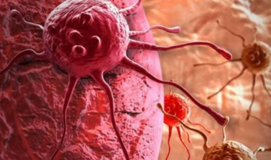 Xərçəngin geniş yayılmış növünə əlac tapıldı - FOTO