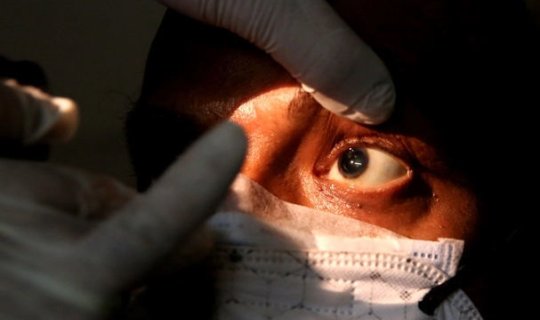 Təhlükəli xəstəliyin fəsadları: “Qara kif” nədir və sağlamlığımıza necə təsir edir?