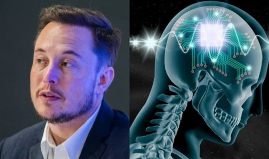 Elon Mask insan beyninə çip yerləşdirməyə başlayır - VİDEO