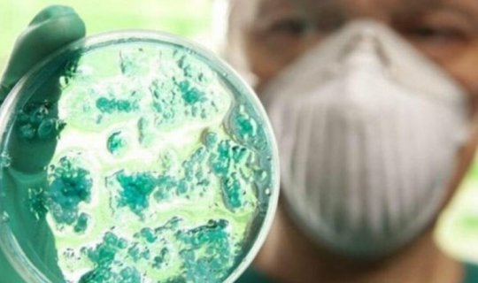 Bu əlamətiniz varsa, qrip deyil, koronavirus olmusunuz