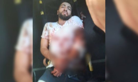 “Bakcell”in əməkdaşı ermənilərin açdığı atəş nəticəsində yaralandı – FOTOLAR