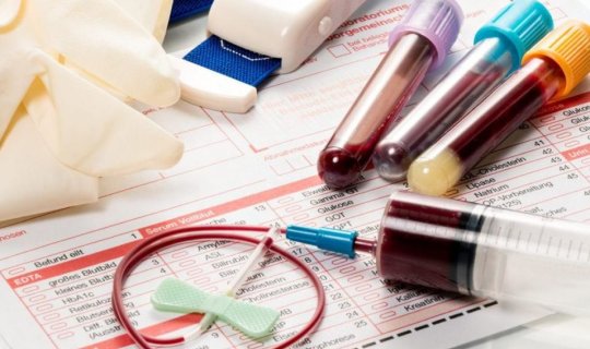 Ümumi qan analizində onkoloji xəstəliyi görmək olurmu? – Hematoloqdan açıqlama