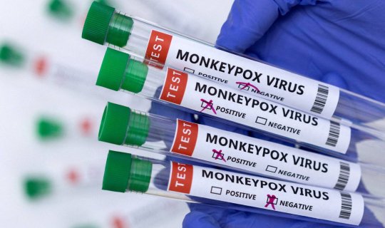 Azərbaycana meymunçiçəyi test dəstləri gətirildi