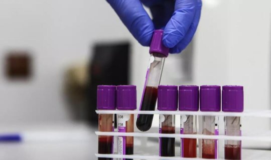 Qan xərçəngi xəstələrini sağaltmaq üçün unikal texnologiya - Malışeva AÇIQLADI