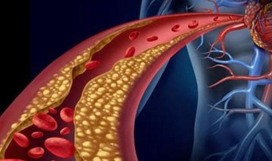 Zəif qan dövranı olanlar nə etməlidir? Həkimdən tövsiyələr