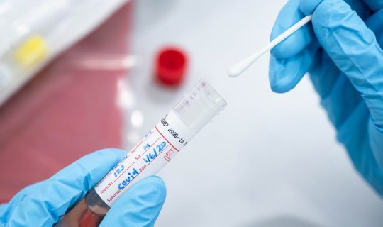 Azərbaycanda yoluxma sayı açıqlandı