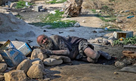 70 il sonra çimdi, faciə ilə sonlandı - FOTO