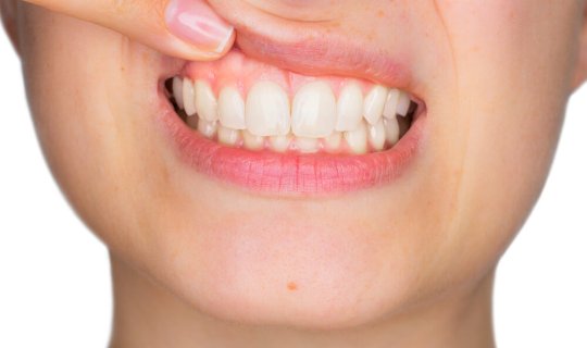 Stressdən uzaq durun! - Dişləriniz çürüyəcək...