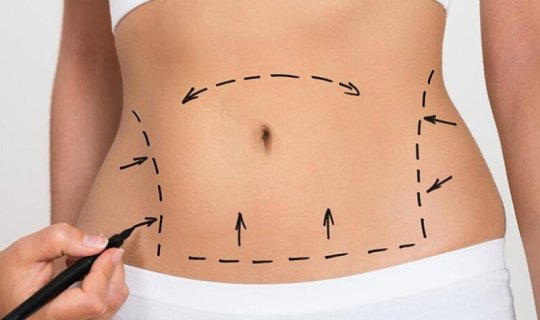 Liposaksiyanın ziyanı nədir?
