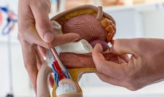 Prostat xərçəngini göstərən tualet simptomları