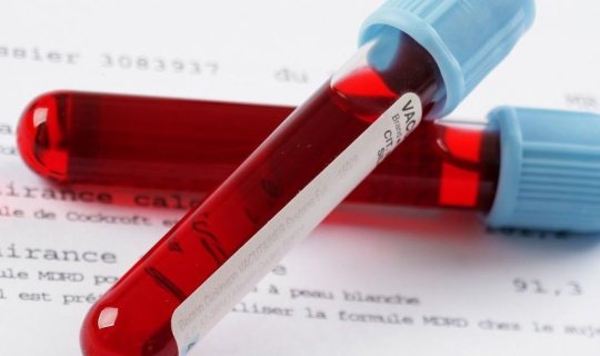Bu qan testi ani ölümü proqnozlaşdıra bilər