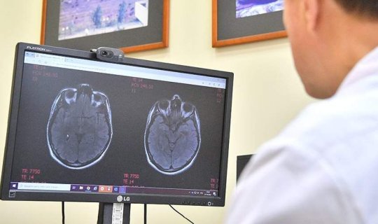Dünyada ilk - 19 yaşlı gəncdə demensiya aşkarlandı