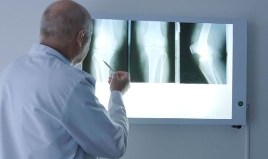 Revmatoloq oynaq ağrısının gözlənilməz səbəblərini açıqladı