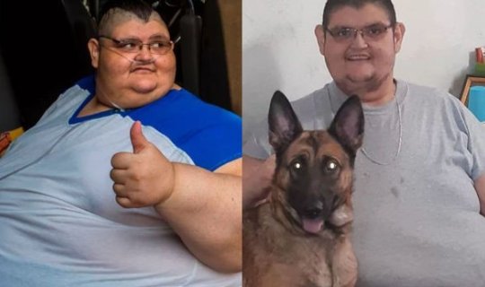 Dünyanın ən kök adamı 330 kiloqram arıqlayıb - FOTO