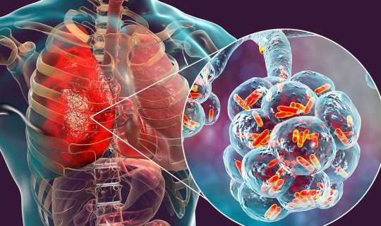 Hovuz və kondisionerlər vasitəsi ilə dəhşətli virus yayılır