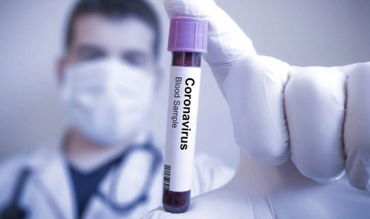 1 həftədə 95 nəfər koronavirusa yoluxub, 3-ü ölüb