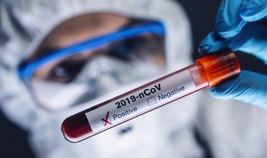 “Koronavirus təhlükəsi hələ sovuşmayıb, arxayın olmamalıyıq”