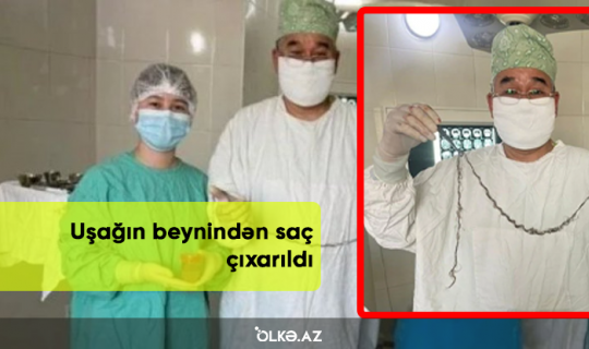 Uşağın beynindən saç çıxarıldı - FOTO