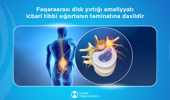 Bu əməliyyat da icbari tibbi sığortanın təminatına daxildir