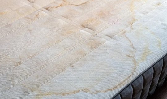 Yataqdakı sarı ləkələr tarixə qovuşacaq
