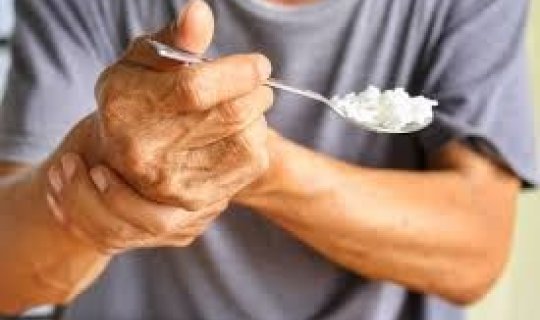 Parkinson xəstəliyinin gözlərdə görünən əlaməti
