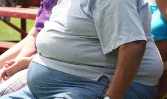 2030-cu ilə qədər yarım milyard yeniyetmə obez olacaq