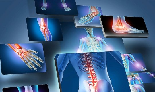 Azərbaycanda oynaq xəstəlikləri: Hansı yaş qrupları risk altındadır?