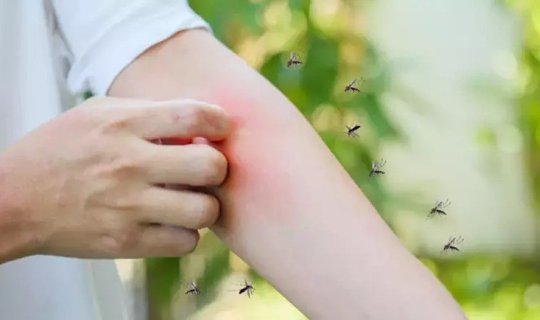 Yayda özünüzü həşəratlardan bu üsullarla qoruyun