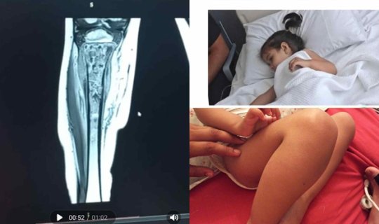 3 yaşlı Zümranın yaşamaq üçün köməyinizə ehtiyacı var - FOTO