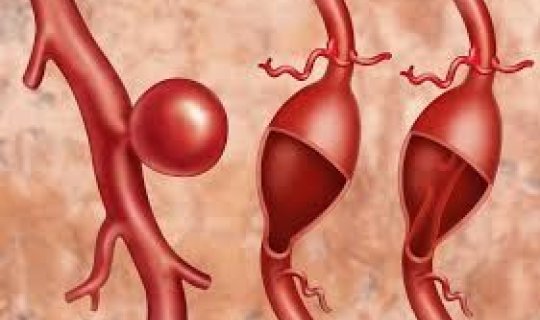 Hansı vitaminin əskikliyi damarları nazildir?
