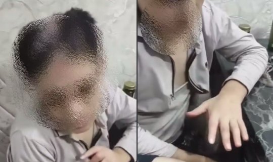 Qəyyumluğa verilən 14 yaşlı yeniyetməyə işgəncə verildi &ndash; Bəs ona kim&nbsp;nəzarət edirdi?
