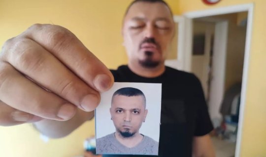 Saçlarını qaraltmaq üçün aldığı şampun həyatını kabusa çevirdi - Foto