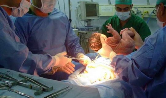 Ağcəbədidə ana doğuş zamanı&nbsp;öldü&nbsp;