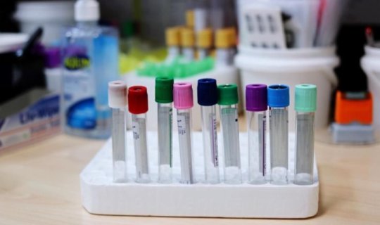 50 yaşdan sonra bu analizlər vacibdir
